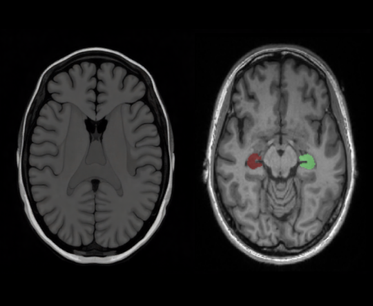 Precision Diagnosis